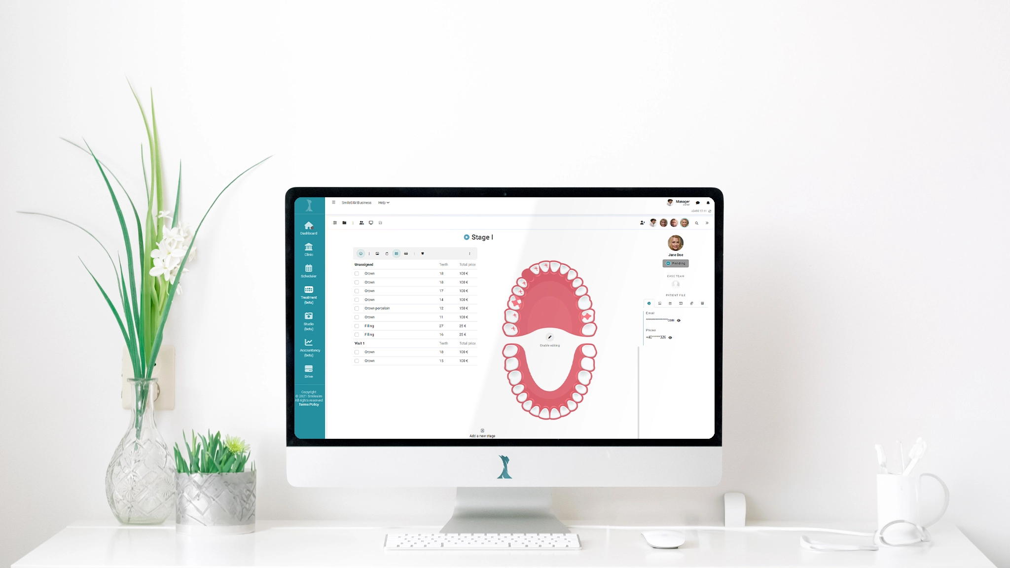 SmileSIM Dental Software App treatment plan stages and visits